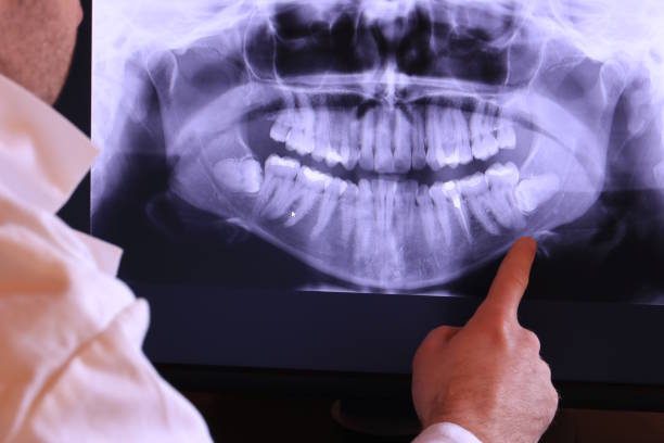 Best Emergency Dentist for Special Needs Patients in Mcleansboro, IL