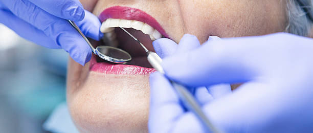 Best Emergency Dental Services for Seniors in Mcleansboro, IL
